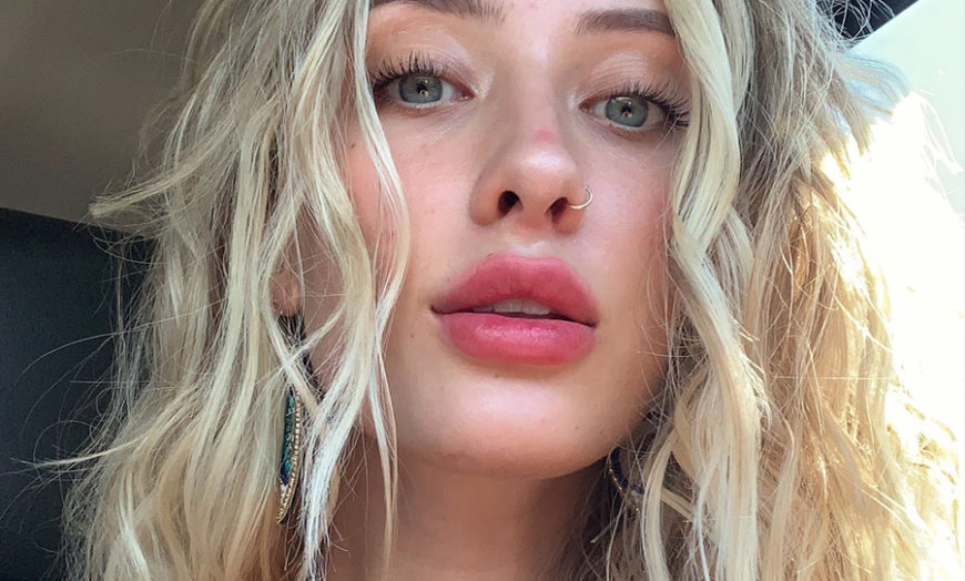 Instagram Model Raised Over $500,000 For Australian 