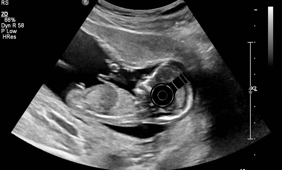 unborn baby album